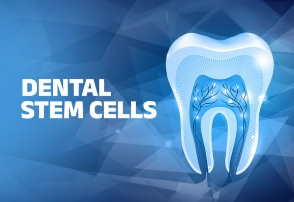 Dental Stem Cells
