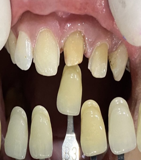 Laminate-IMG_3537-1 Laminate-IMG_3537-1