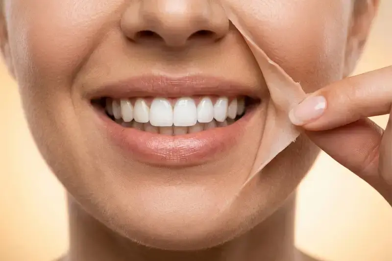 Smile-design