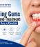 Bleeding Gums Causes and Treatment: When to See a Dentist