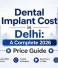 Dental Implant Cost in Delhi: A Complete 2026 Price Guide