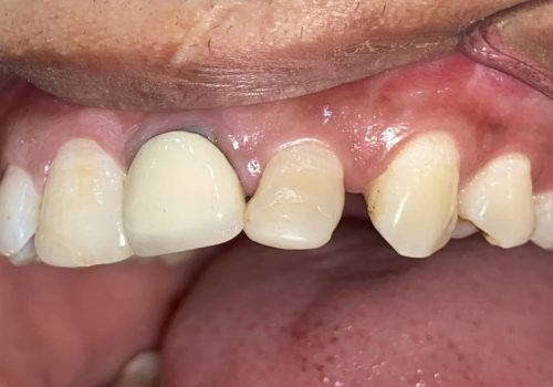 Laminate-IMG_3531 Laminate-IMG_3531