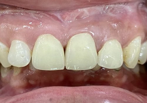 Laminate-IMG_E3602 Laminate-IMG_E3602